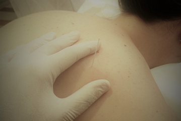 Fisioterapia Cancelada