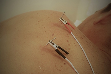Fisioterapia Cancelada
